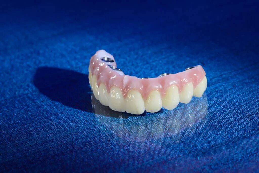 Зубные протезы нового поколения цена. Титановые зубные протезы. Самые красивые зубные протезы.