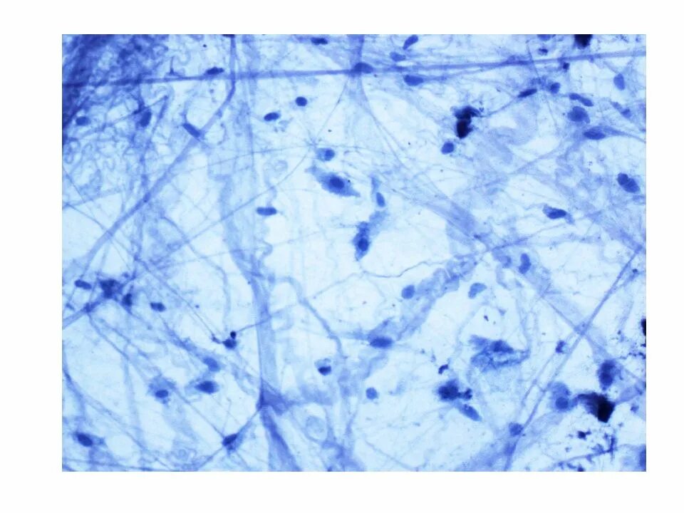 Рыхлая волокнистая соединительная ткань препарат. Рыхлая волокнистая неоформленная соединительная ткань гистология. Рыхлая волокнистая соединительная ткань препарат. Рыхлая волокнистая соединительная ткань. Макрофаг в рыхлой соединительной ткани.