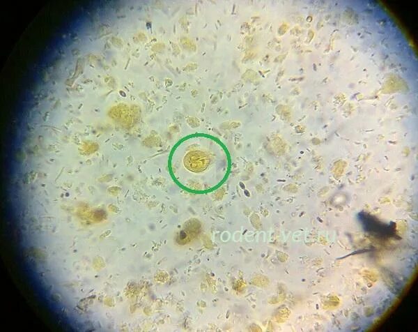 Цисты лямблии микроскопия. Циста лямблии под микроскопом. Цисты лямблий в Кале под микроскопом. Цисты лямблий микроскопия.