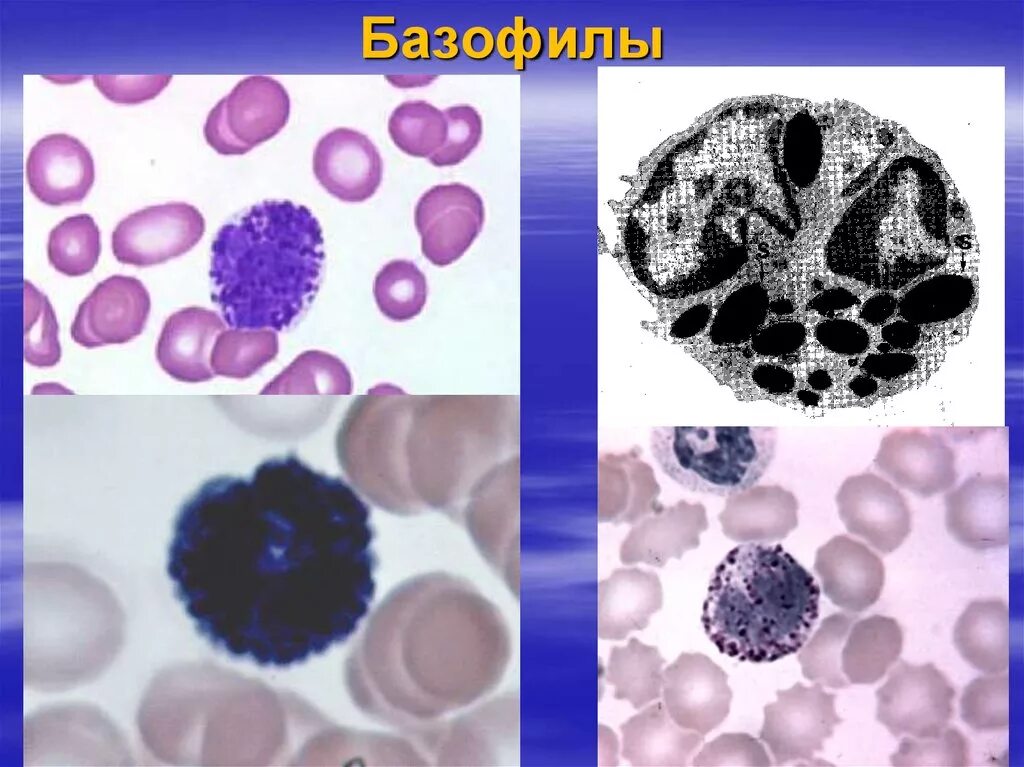 Базофилы 0.00. Базофил в микроскопе. базофилы форма клетки. базофилы абс 0.02. базофилы микроскопия.