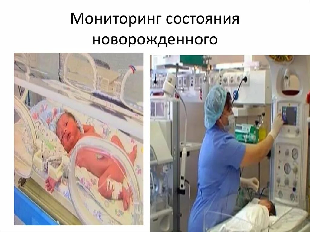 Мониторинг состояния ребенка. Мониторинг состояния новорожденного. состояние новорожденного. терминальное состояние новорожденного. перинатальный центр презентация.
