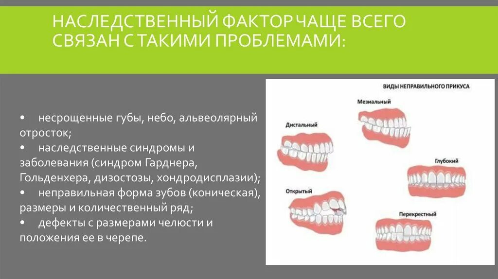 Факторы возникновения зубочелюстных аномалий. Наследственные аномалии зубочелюстной системы. Классификация прикусов.
