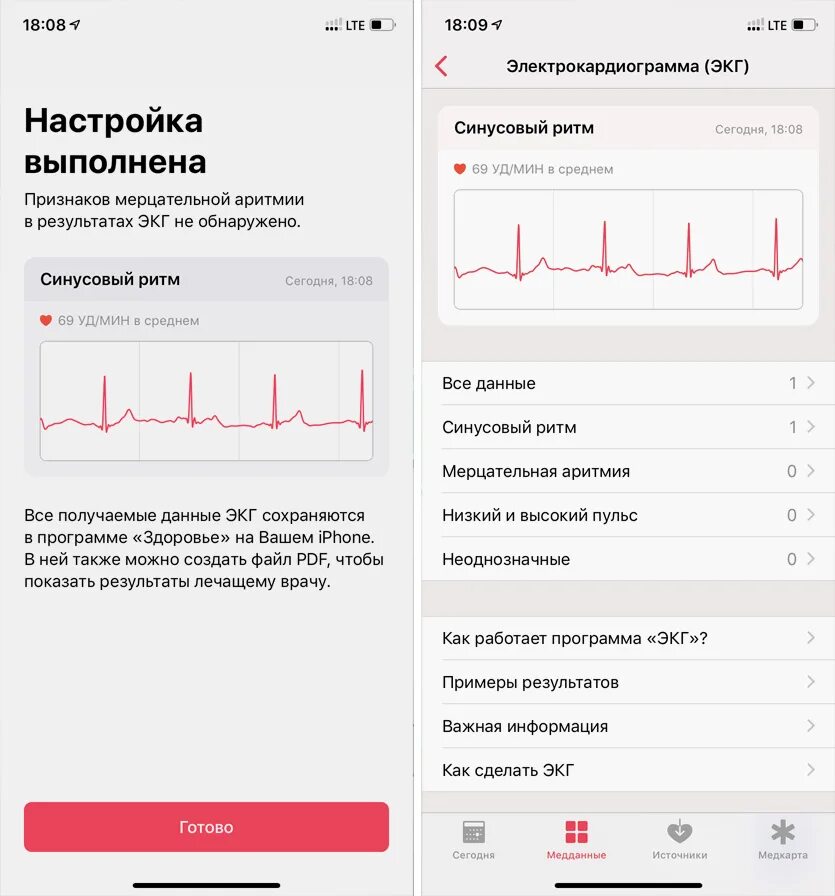 Экг программа. Экг эпл вотч 7. настройки экг. экг apple watch. экг приложение.