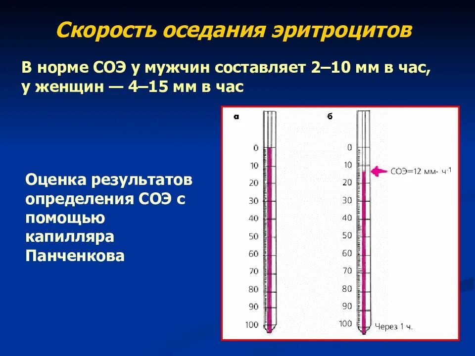 Что значит соэ в крови у женщин. Метод Панченкова СОЭ. Исследование скорости оседания эритроцитов по Панченкову. Скорость реакция оседания эритроцитов норма. СОЭ по Панченкову норма.