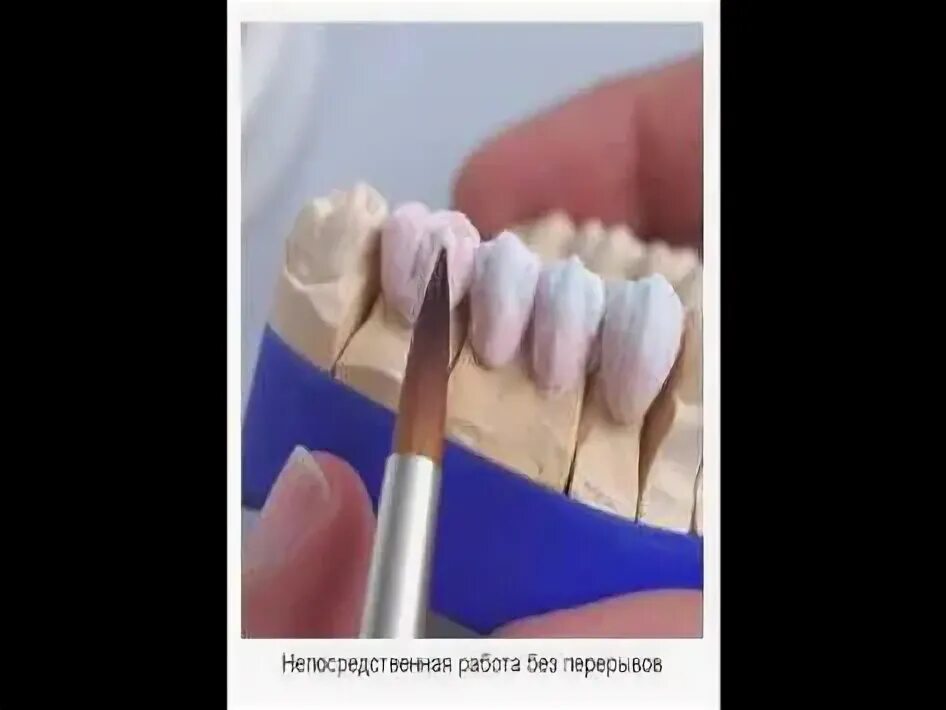 Средства гигиены для больных. Кисточки для керамики зубной техник. Кисть зуб. Кисточки для керамики зубной техник. Корневая (радикулярная) киста.