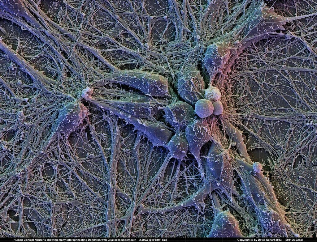 Нейронная сеть человеческого мозга. Нейрон клетка головного мозга. Нейрон микрофотография. Аксон нейрона микрофотография. Нейрон Пуанкаре микрофотография.