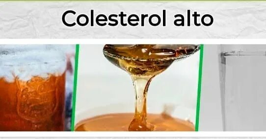 Colesterol bueno alto que significa