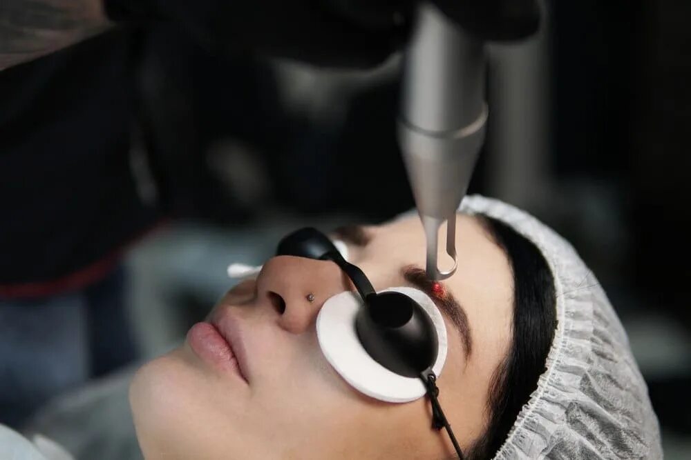 Лазер брови. Удаление пм лазером. Удаление пм лазером. Удаление пм лазером. Перманентный макияж лазером.