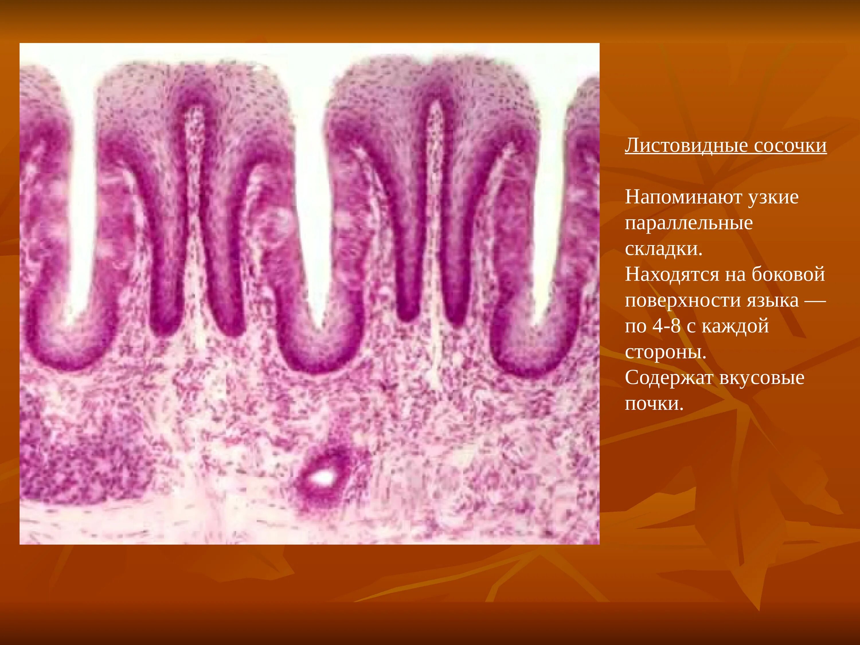 листовидные сосочки строение гистология. вкусовые сосочки языка гистология препарат. листовидные сосочки языка препарат. вкусовые почки гистология препарат. нитевидный сосочек языка гистология.