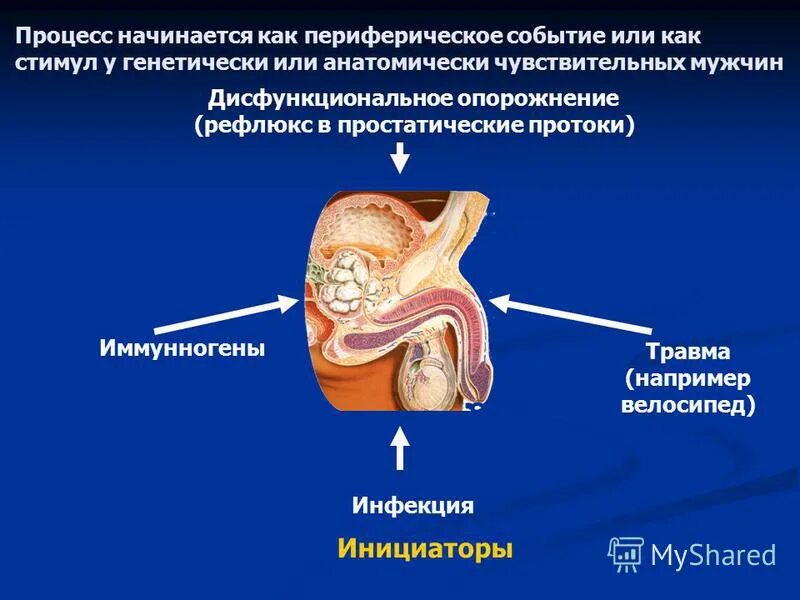 Хроническая тазовая боль у мужчин. Синдром хронической тазовой боли. Синдром хронической тазовой боли (СХТБ).