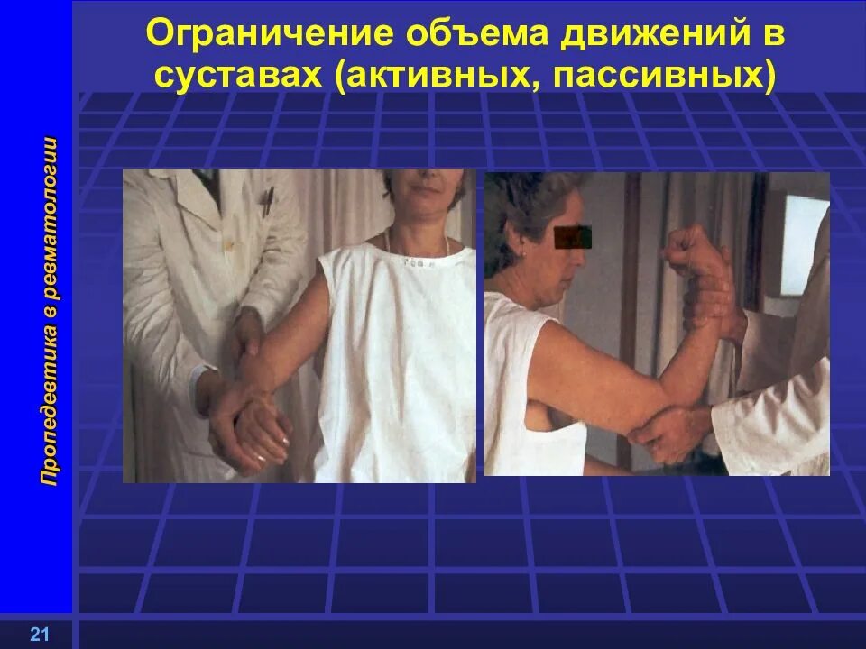 Объем пассивных движений. Ограничение объем активных и пассивных движений в суставах. ограничение пассивных движений в суставе. объем движений в суставах пропедевтика. измерение объема активных движений в суставах.