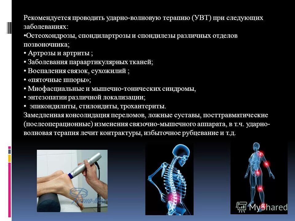 увт поясничного отдела позвоночника. механизм ударно-волновой терапии?. ударно волновая терапия при грыже позвоночника отзывы. ударно волновая терапия при грыже позвоночника отзывы. ударно-волновая терапия остеохондроз.