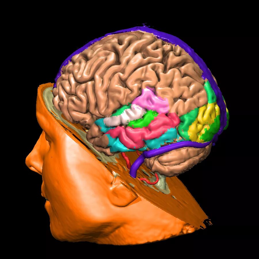 Последний мозг. Фотография головного мозга.