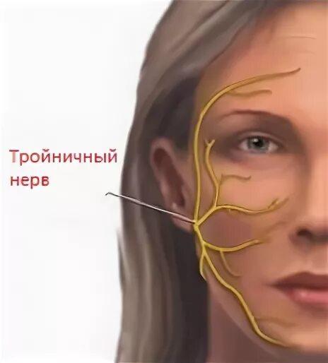 Воспаление тройничного лицевого нерва. Лицевой нерв и тройничный нерв. Тройничный лицевой нерв симптомы. Воспаление тройничного нерва на лице симптомы.