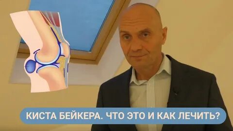 Лечение кисты спб