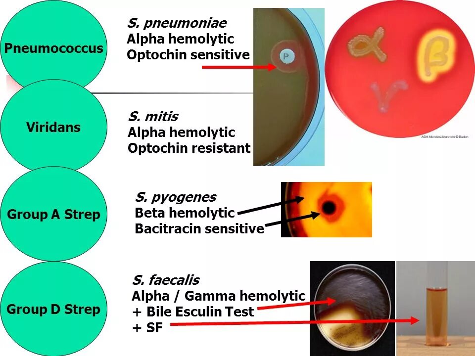 Тест на стрептококки в аптеке. Streptococcus pneumoniae (пневмококк). Тест на стрептококков. Streptococcus pneumoniae мобилины. Streptococcus Viridans пневмония.