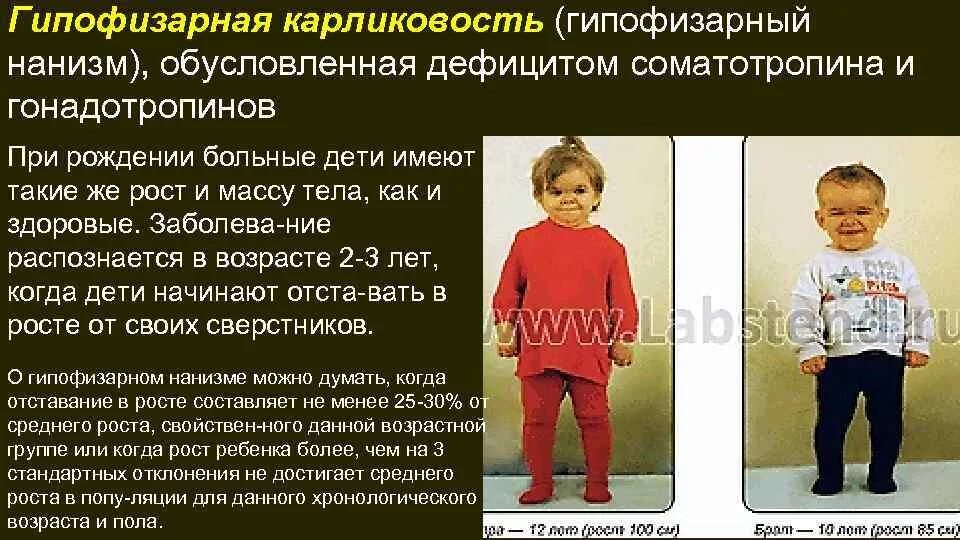 Карликовость функции. &quot;эпифизарная карликовасть&quot;. гипофизарный нананизм. гипофизарный нанизм (карликовость). гипофизарный нанизм обусловлен.
