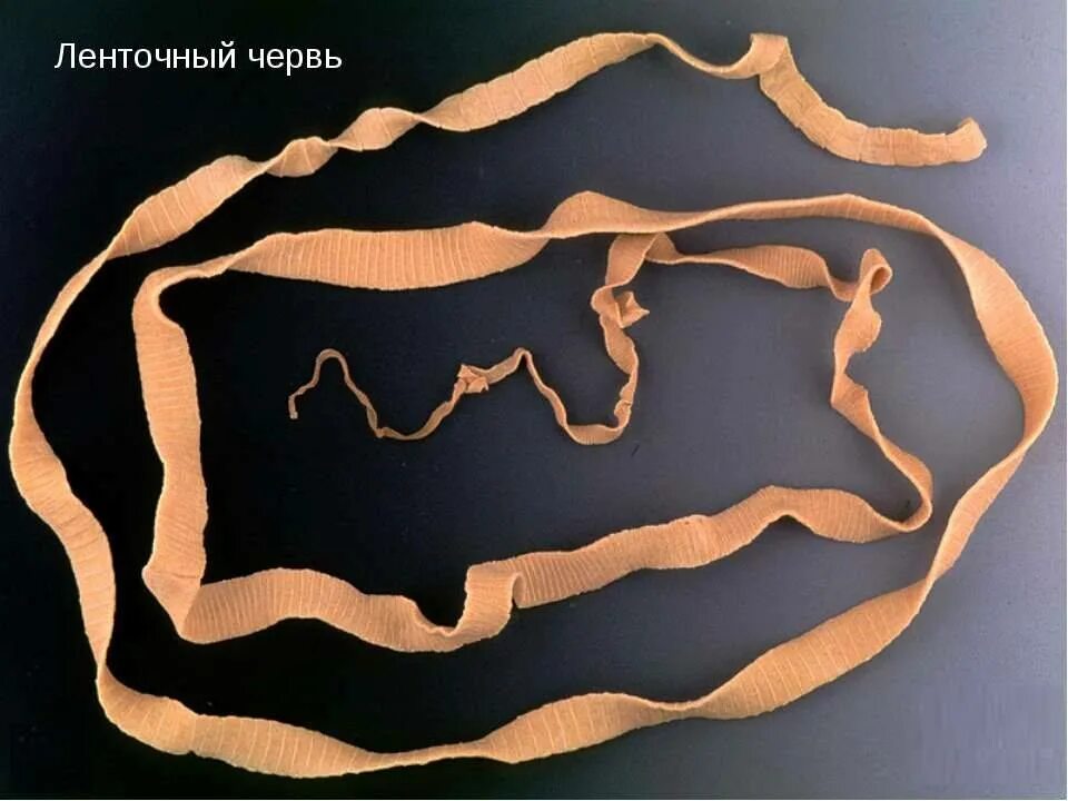 6 бычий цепень. Ленточный червь лентец. ленточные черви цепень. ленточные черви бычий цепень. ленточный червь бычий цепень.