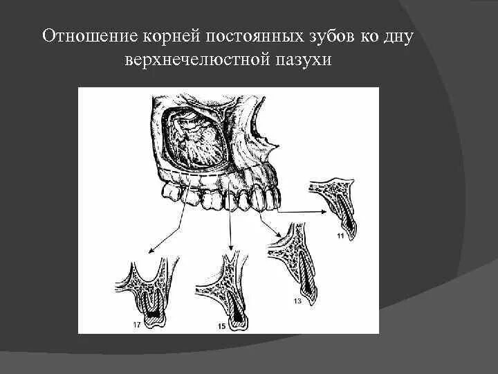 Варианты строения верхнечелюстной пазухи. Гайморова пазуха и зубы анатомия. Взаимоотношение гайморовой пазухи с корнями.