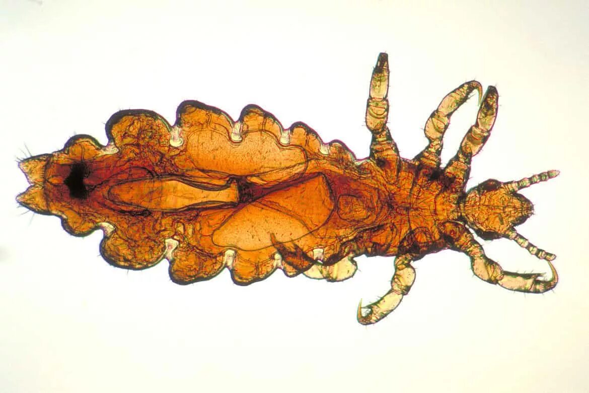 Вша класс. Представители вшей насекомых биология 7. Головная вошь (pediculus humanus capitis). Вши характерные признаки отряда. Отряд вши строение.