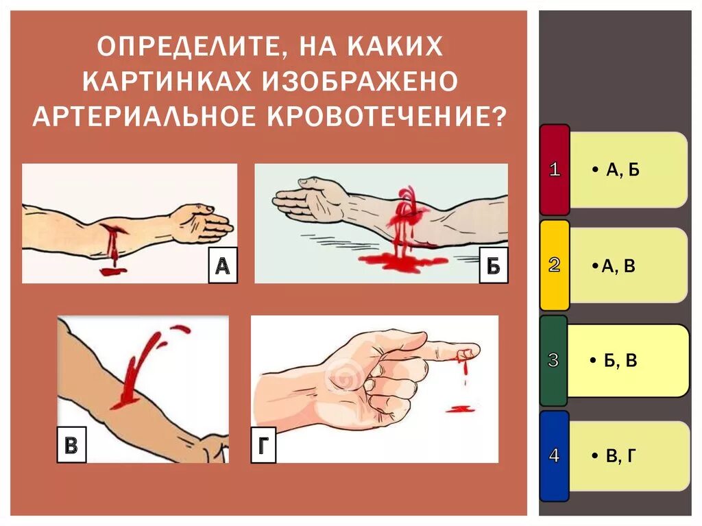 Тест определите кровотечение. Артериальное кровотечение. Артериальное венозное и капиллярное кровотечение. Капиллярное кровотечение арт. Изображено артериальное кровотечение?.