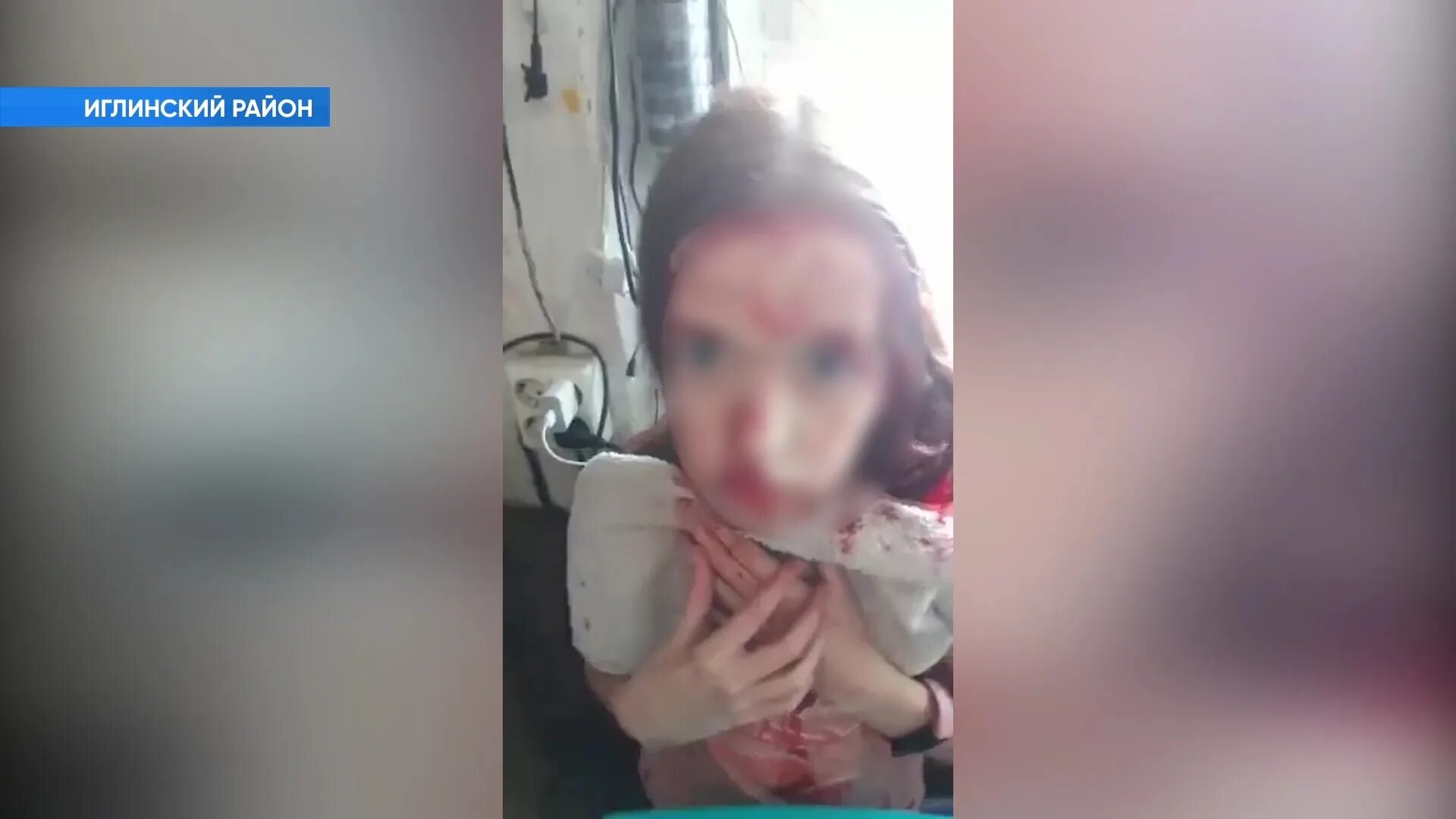 Включи девочка напала. Фото 15 летней девочки. Включи девочка напала. Нападение на девушку на улице за шею. Подростки избили девочку.