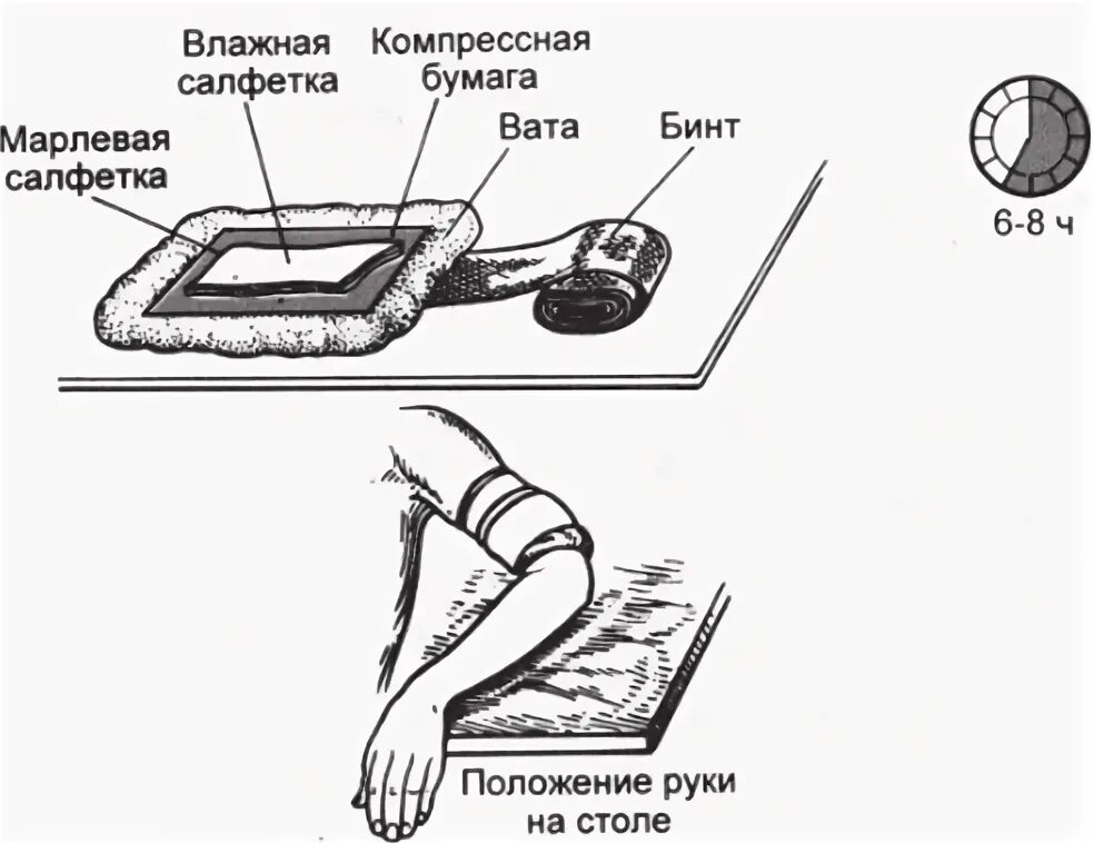 Можно ли делать компресс на лимфоузлы. Обучите пациента правилам наложения согревающего компресса.. Методика наложения согревающего компресса. Согревающий спиртовой компресс алгоритм. Полуспиртовой компресс алгоритм.