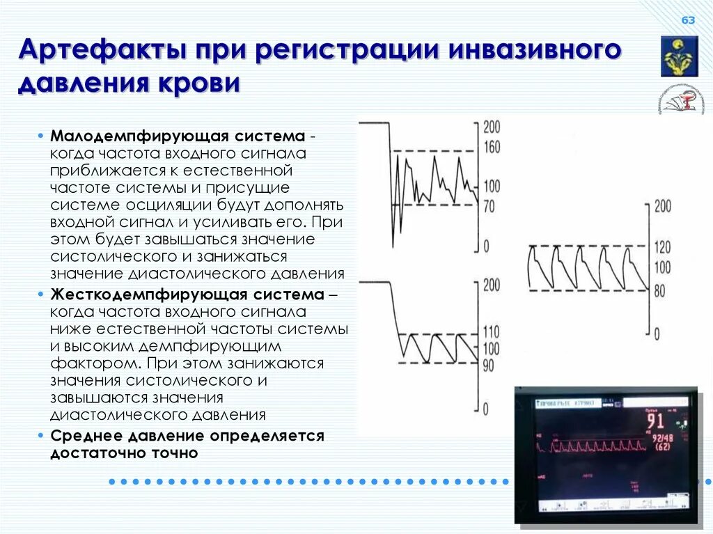 Частота входного сигнал ф. Инвазивный датчик давления крови. Инвазивный мониторинг гемодинамики Nihon.