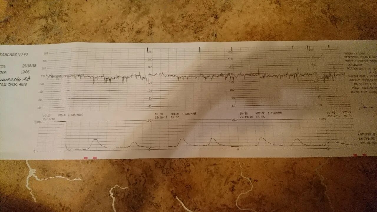 40 недель беременности нет схваток. КТГ 40 недель. КТГ 40 недель нормы. 40 На КТГ что это. КТГ на 40 неделе беременности.