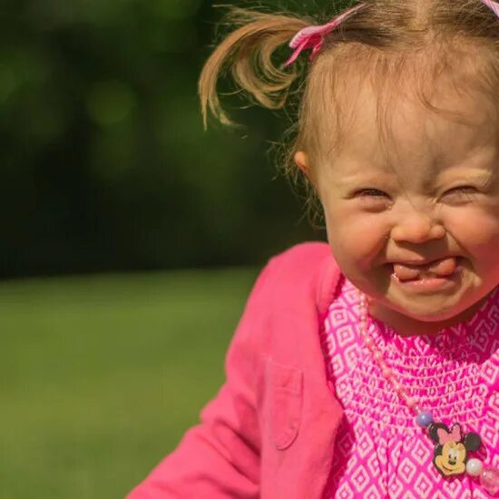 Солнечные дети. Ребенок даун. Дети инвалиды дауны. Ребенок инвалид синдром дауна. Инвалид аутист.