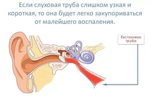 Закладывает уши при посадке что делать. Слуховая евстахиева труба. Отит евстахиевой трубы. Воспаление слуховой евстахиевой трубы.