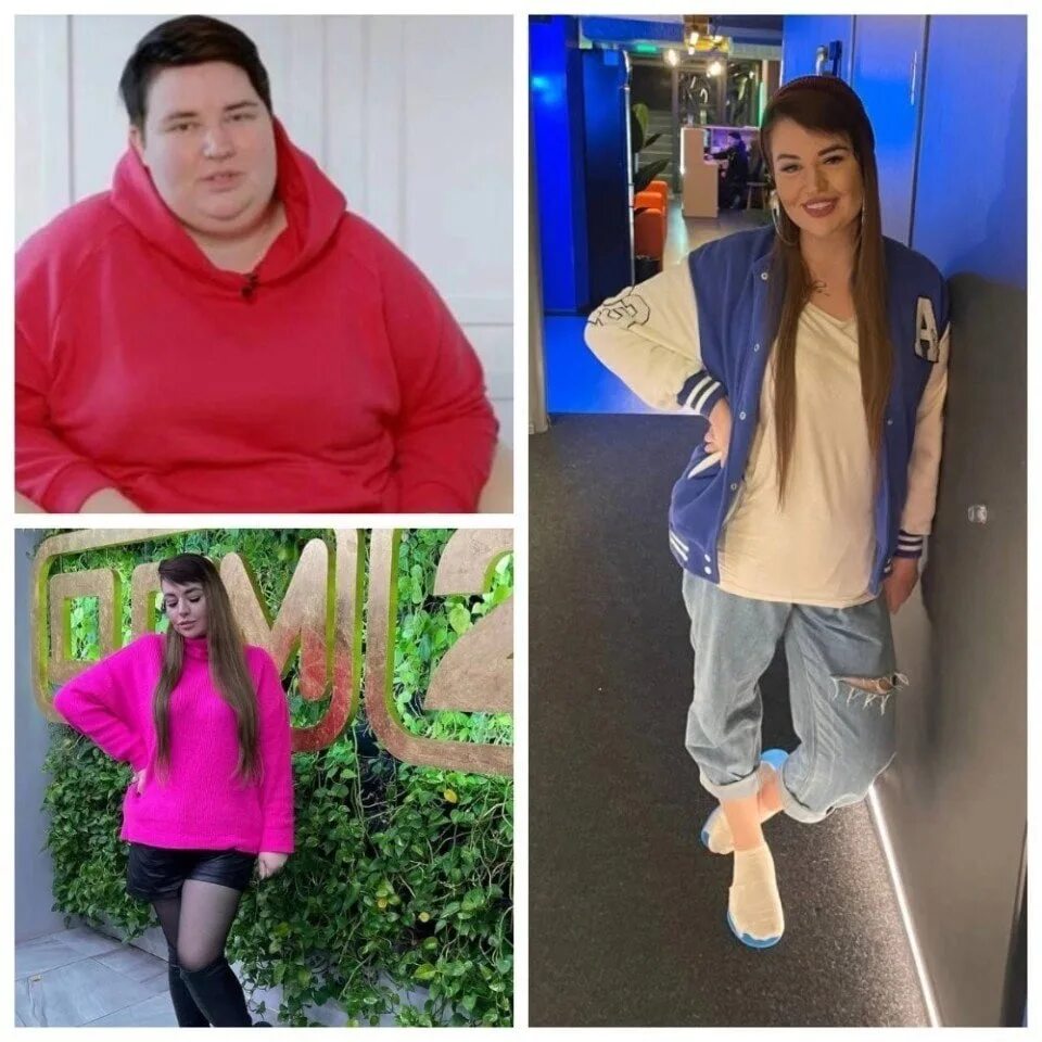 Черно до и после операции Alexandra Cherno on Instagram Spring ! Time for change ! Especially for me, I ca