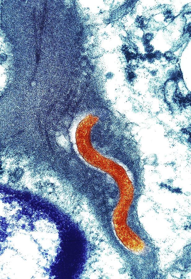 1 treponema pallidum. 1 treponema pallidum