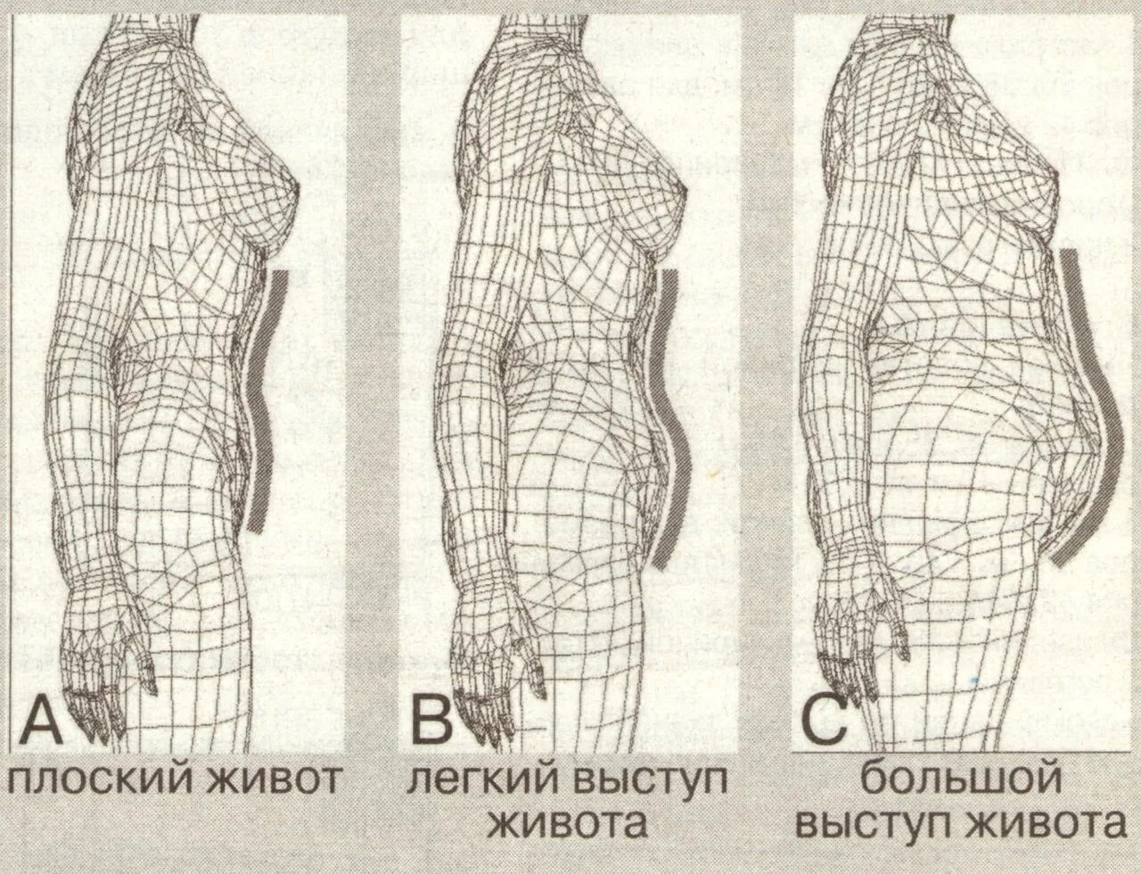 Типы живота. Форма живота. форма живота виды. формы живота у женщин. разные формы живота у женщин.
