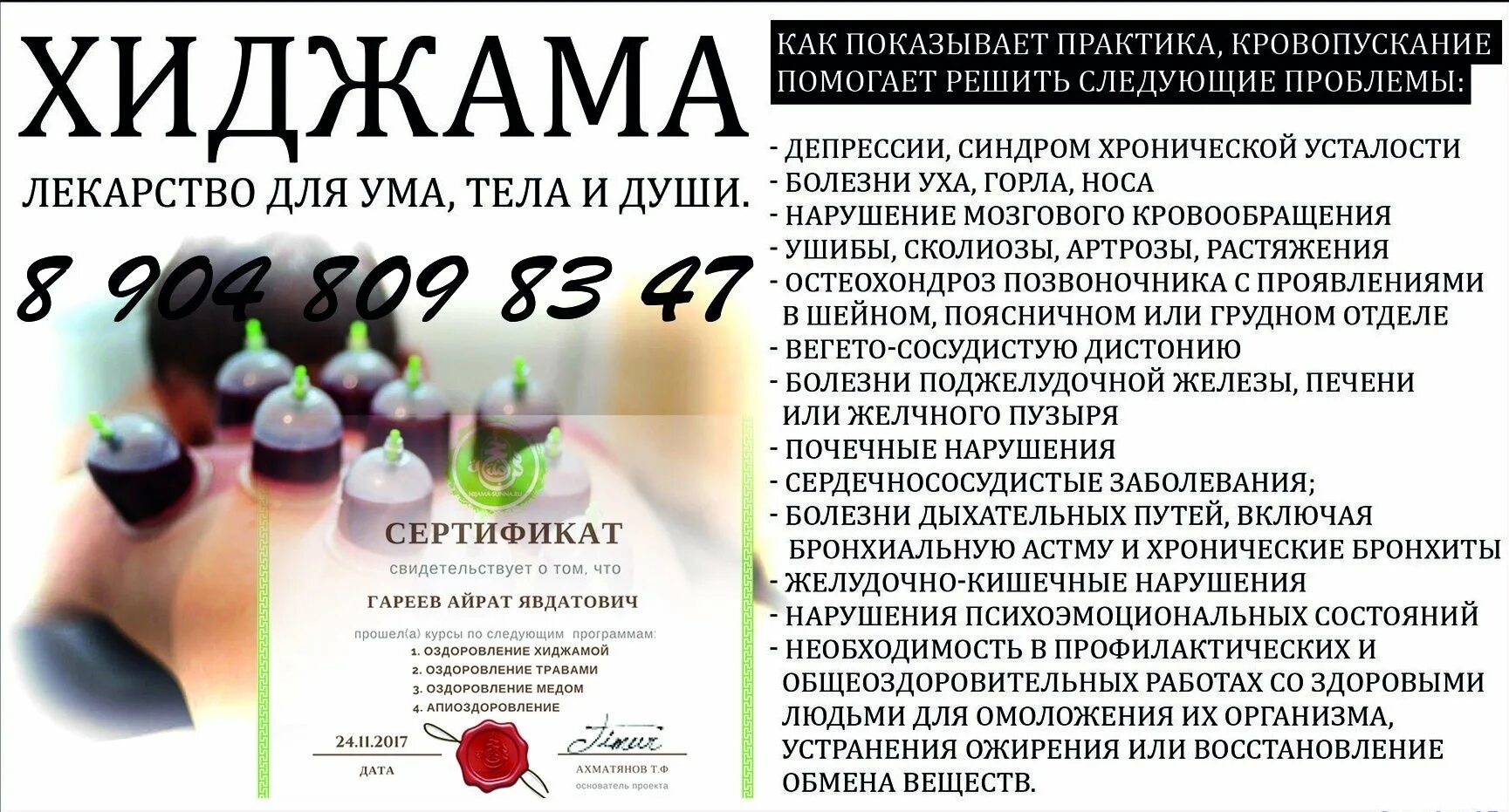 Вакуумный массаж хиджама. Оздоровительная хиджама. Капиллярное кровопускание хиджама. Хиджама банки показания. Банки для кровопускания хиджама.