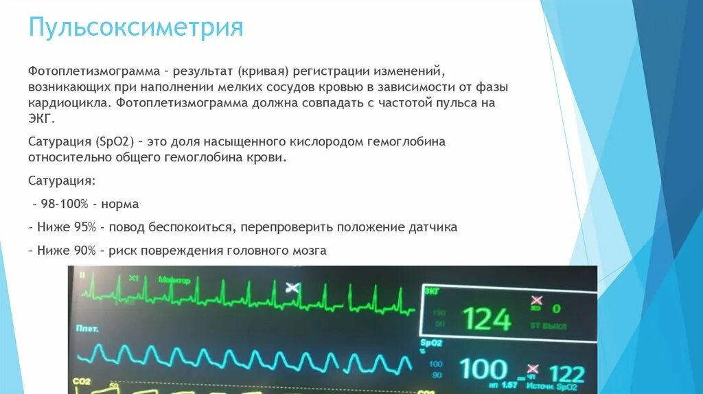 Пульсоксиметрия результаты. Пульсоксиметрия подготовка пациента. подготовка пациента к наркозу. пульсоксиметрия презентация. пульсоксиметрия в анестезиологии.
