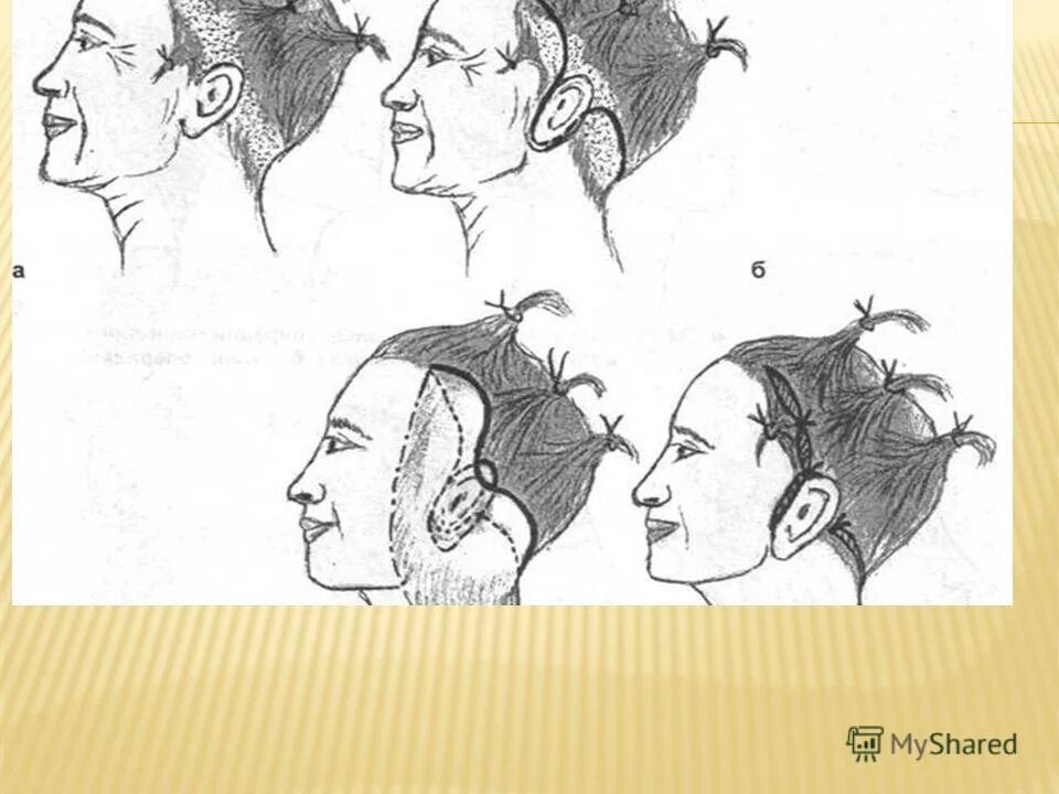 У взрослого человека голова занимает. Рисунок верхней части головы. Передняя часть головы стрижка. Форма головы человека. Фронтальная сторона головы.