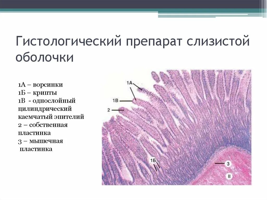 Строение слизистой оболочки гистология. Тонкая кишка гистология препарат. Слизистая оболочка пищевода гистология. Собственная пластинка слизистой оболочки гистология. Установите соответствие слизистая оболочка