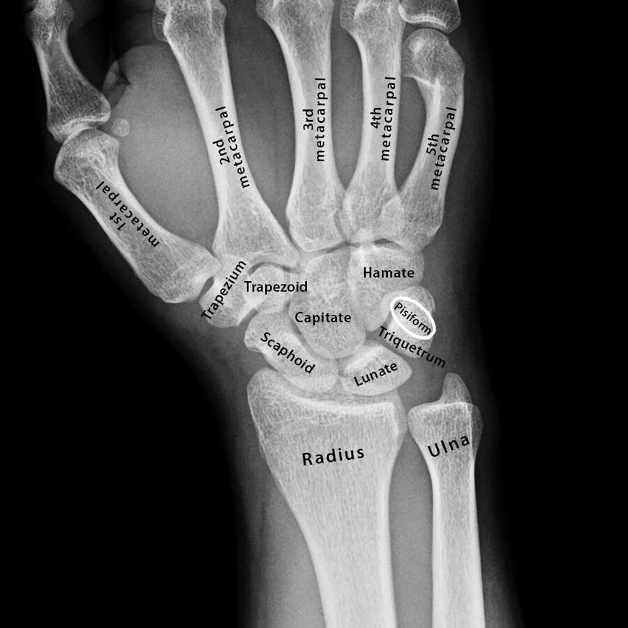 Carpal Anatomy. Trapezium кость. Capitate кость. Wrist Bones Anatomy. Bones ray