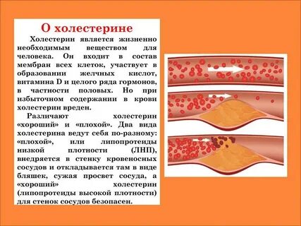 Сухое вино и холестерин