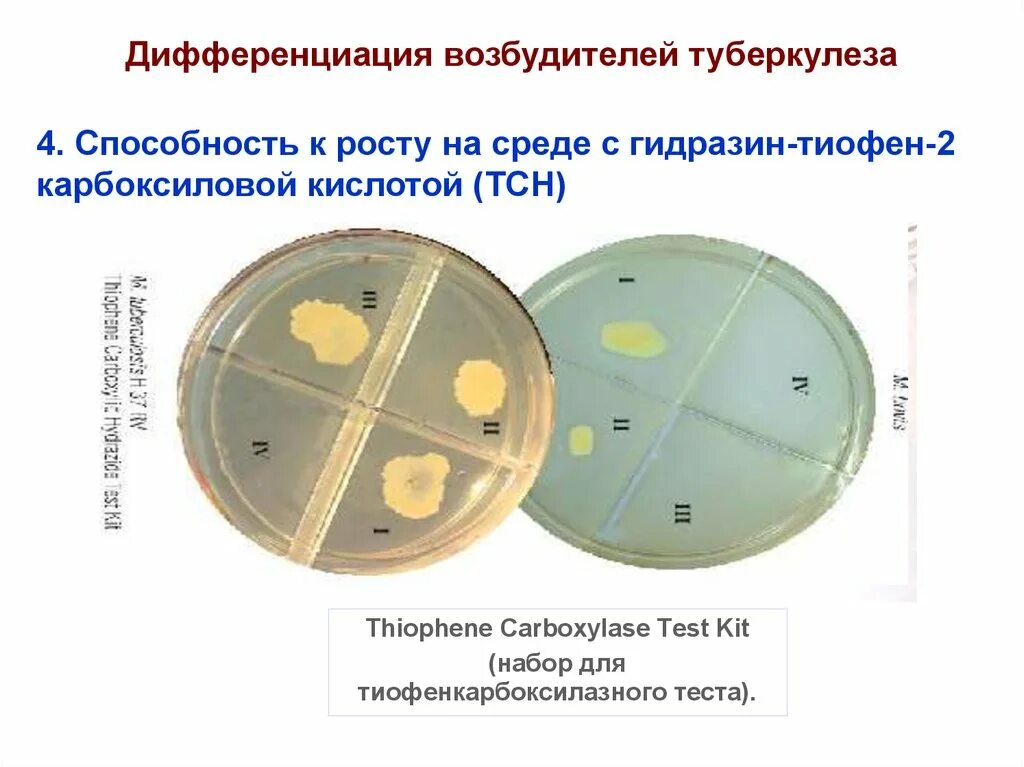 Туберкулез возбудитель заболевания. Микобактерии форма бактерии. Палочка коха возбудитель туберкулеза. Микобактерии кислотоустойчивые бактерии. Возбудителем туберкулеза является тесты.