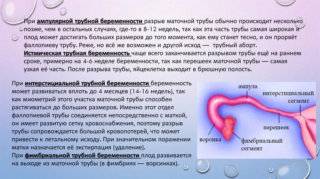 Причины вб. Беременность в маточной трубе. Внематочная беременность разрыв маточной трубы. После удаления маточной трубы.