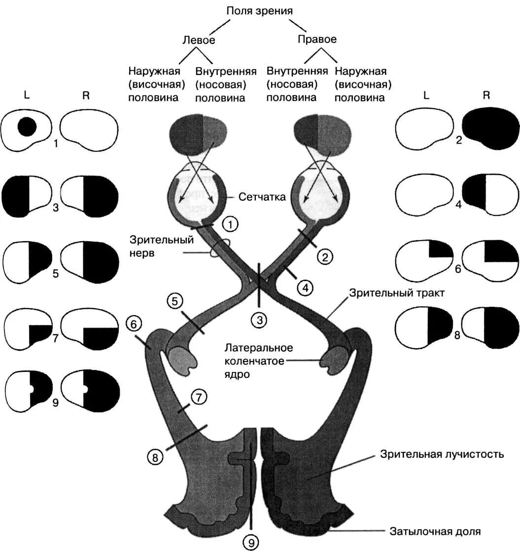 Поля зрения путей зрительного анализатора. Нарушения зрительных полей. Выпадение полей зрения при поражении. Поле зрения нарушения. Поражение зрительного анализатора на различных уровнях.