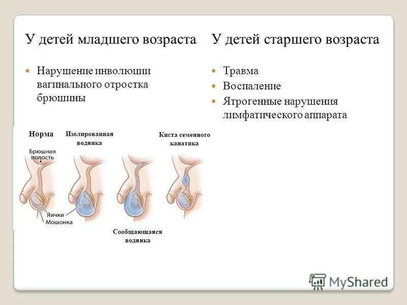 Неопускание яичек у ребенка. Опускание яичек у мальчиков. Не опускаются яички что делать