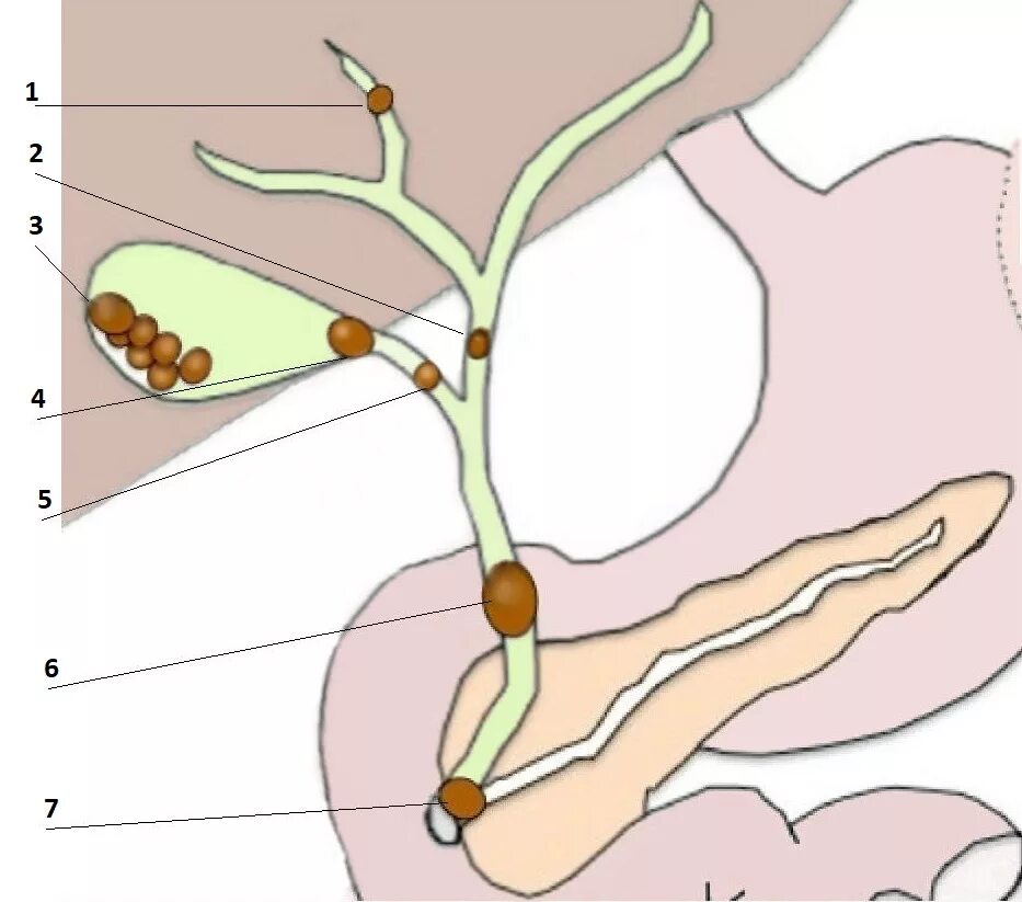 Симптомы забитых желчных протоков. Схема желчного пузыря и протоков. Холедох пузырный проток. Желчные протоки холедох. Холедох проток желчного пузыря.