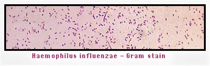 Haemophilus в мазке у мужчин. Гемофилюс инфлюэнца морфология. Палочка инфлюэнцы.