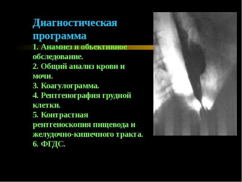 Кт пищевода и желудка. Перфорация пищевода рентген. Контрастная рентгенография пищевода. Рентгеноскопия пищевода. Заболевания пищевода на рентгенограмме.