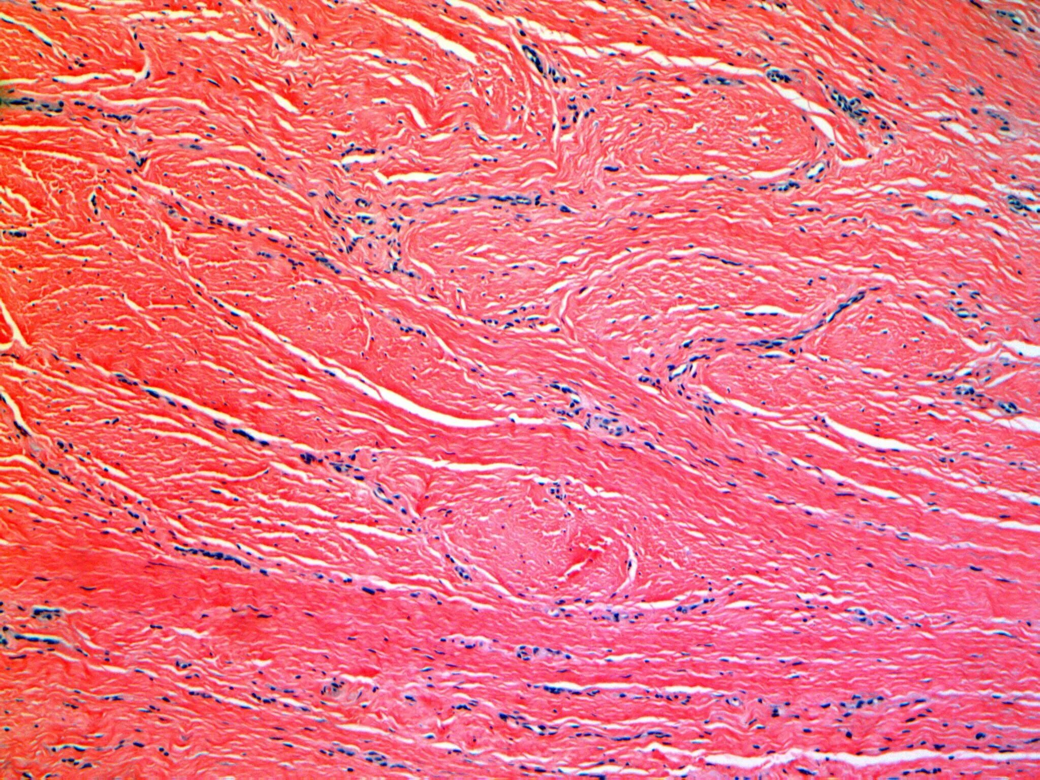 Мышечные клетки гистология. Гладкая мышечная ткань микропрепарат. Коллаген микрофотография. Коллаген в сосудах гистология.