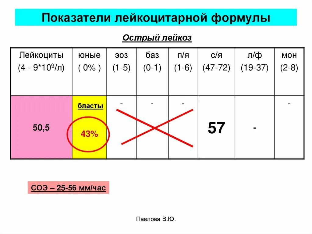 Лейкоцитарная формула при остром лейкозе. ХМЛ лейкоцитарная формула. Острый лейкоз лейкоцитарная формула. Лейкоформула при остром лейкозе. Изменения в лейкоцитарной формуле