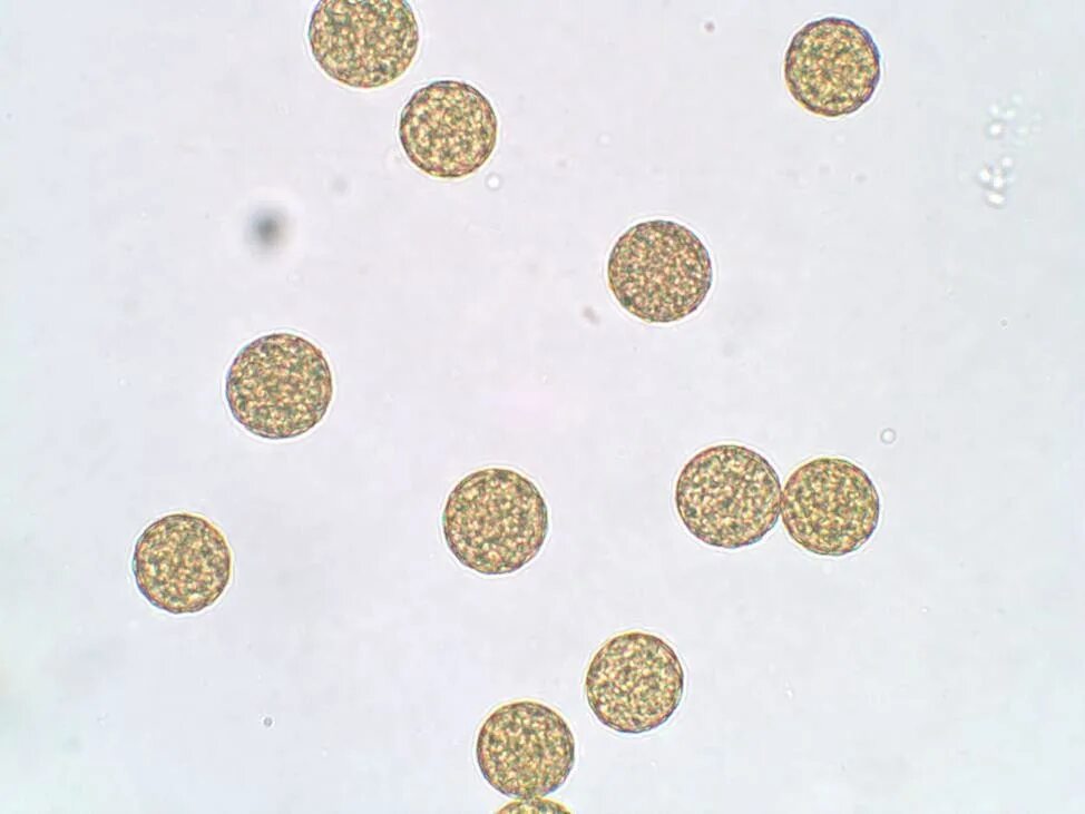 Пыльца и споры. Пыльца в микроскопе. Пыльца микроскопия палинология. Пыльца в Кале под микроскопом. Пыльцевое зерно микроскоп.